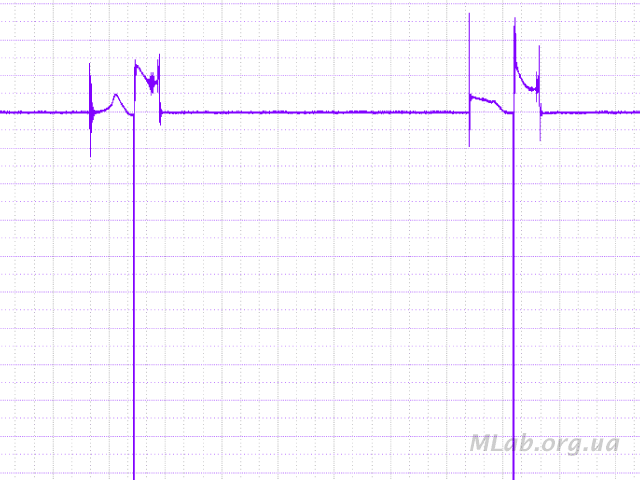 неправильная осциллограмма вторичного напряжения системы зажигания